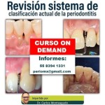 Revisión sistema de clasificación actual de la periodontitis $USD
